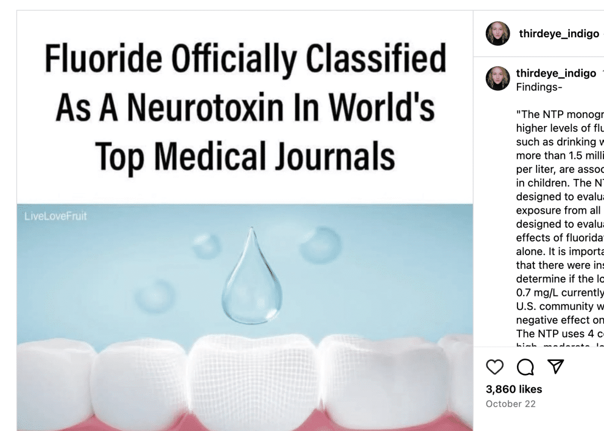 fluoride community water neurotoxicity