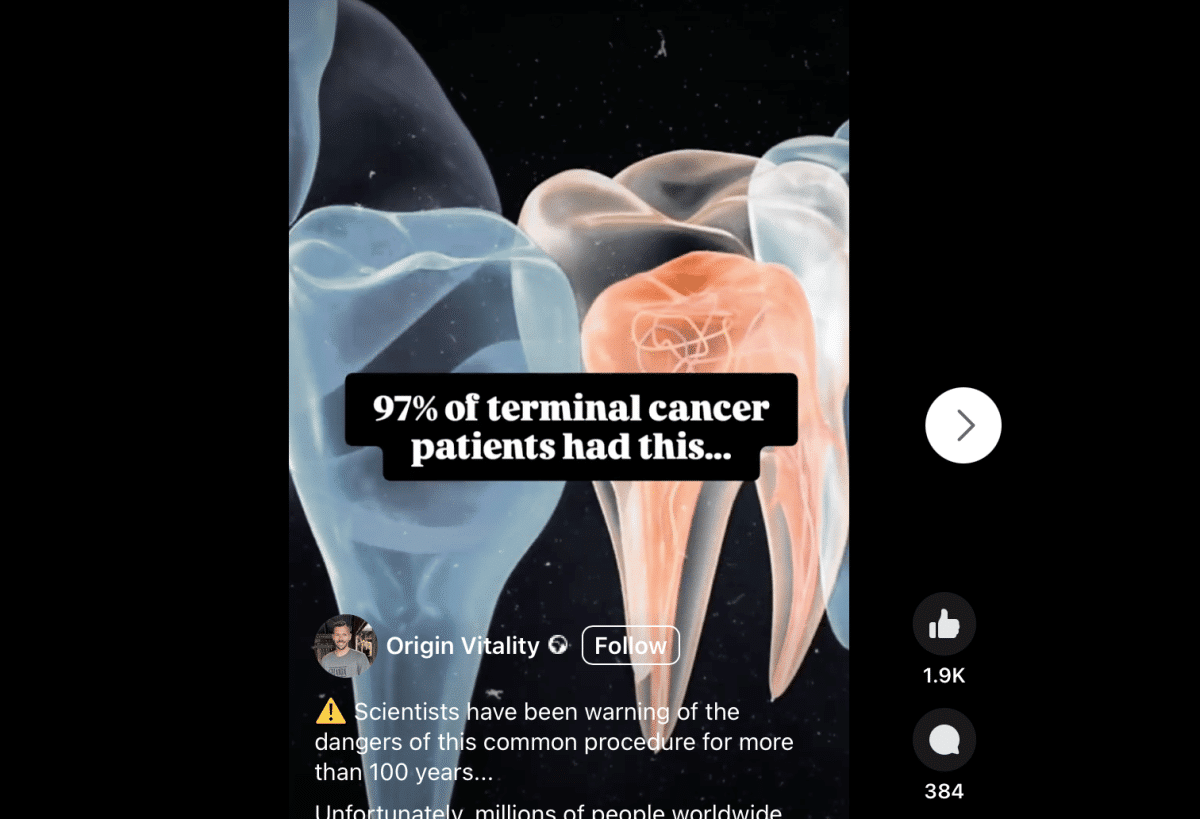 root canal cancer teeth